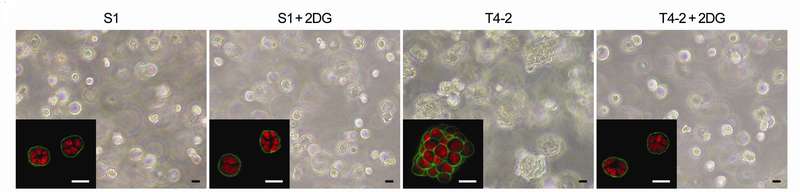 These phase contrast and confocal immunofluorescence images (inset) show 3-D cultures of non-malignant (S1) and malignant (T4-2) human breast cells in which glucose metabolism is inhibited by the addition of 2-deoxy-D-glucose (2DG). Suppressing glucose uptake leads to a phenotypic reversion of malignant cells (they look normal) while not affecting the non-malignant cells. (Source: Berkeley Lab)