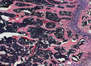 Microscopic view of mouse bone. (Source: UCLA)