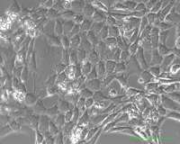 Pancreatic cancer cells growing in a laboratory dish. (Source: Johns Hopkins University School of Medicine/James Eshleman)