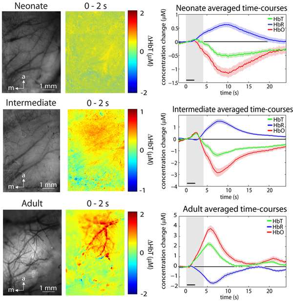 Development of the hemodynamic response. Left: Representative gray-scale MS-OISI images of the cortical surface and difference maps displaying changes in total hemoglobin concentration in response to stimulation for three age groups. Right: Averaged oxygenated, deoxygenated, and total hemoglobin time-courses for each age group. Gray region denotes the stimulation period. (Source: Columbia University)