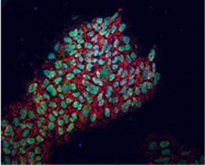 For the first time, the Belmonte laboratory has replaced OCT4, one gene previously thought indispensable for the reprogramming of human cells into embryonic-like cells. The picture shows newly reprogrammed cells expressing marks of pluripotency as identified by fluorescence (NANOG in green, TRA-1-81 in red). (Source: Salk Institute for Biological Studies)