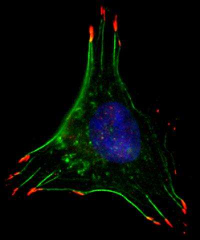 In low oxygen conditions, breast cancer cells form structures that facilitate movement, such as filaments that allow the cell to contract (green) and cellular 'hands' that grab surfaces to pull the cell along (red). (Source: Daniele Gilkes)